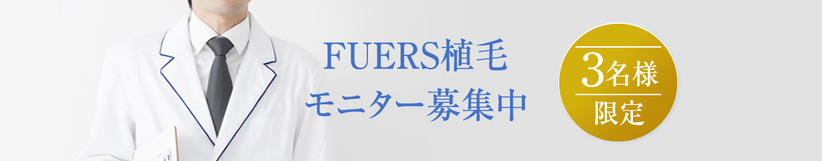 モニター募集