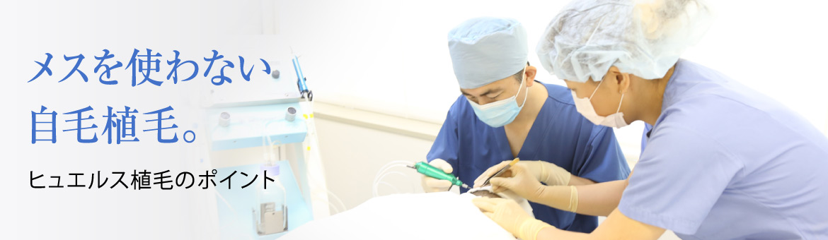 メスを使わない自毛植毛。