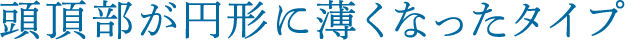 頭頂部が円形に薄くなったタイプ